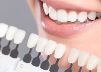 Современные ультратонкие виниры